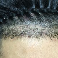 發(fā)際線用戶圖片