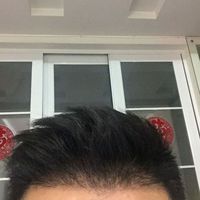 發(fā)際線用戶圖片
