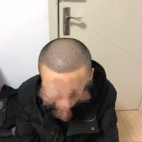 發(fā)際線用戶圖片