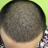 發(fā)際線用戶圖片