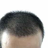 發(fā)際線用戶圖片