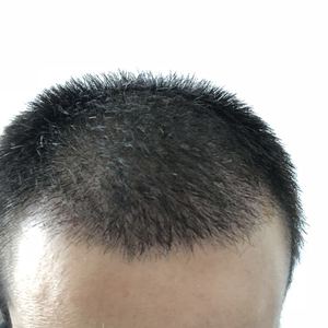 发际线分享社区