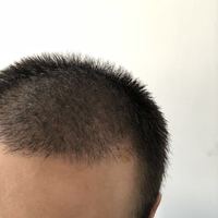 發(fā)際線用戶圖片