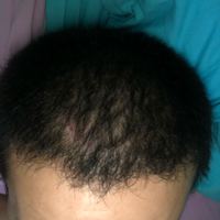 發(fā)際線用戶圖片
