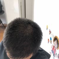 發(fā)際線用戶圖片