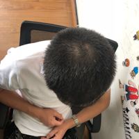 發(fā)際線用戶圖片