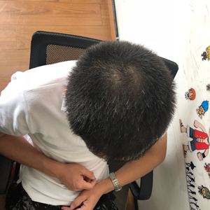 发际线分享社区