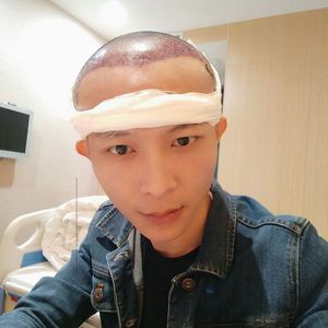 发际线分享社区