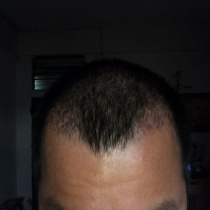 发际线分享社区