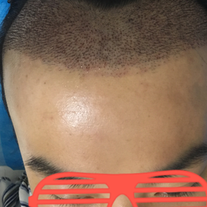 发际线分享社区