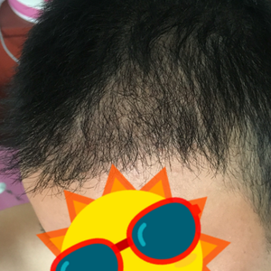 发际线分享社区