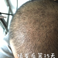 發(fā)際線用戶圖片