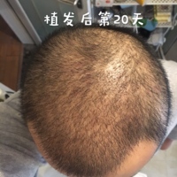 發(fā)際線用戶圖片