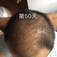 發(fā)際線用戶圖片