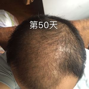 发际线分享社区