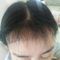 發(fā)際線用戶圖片