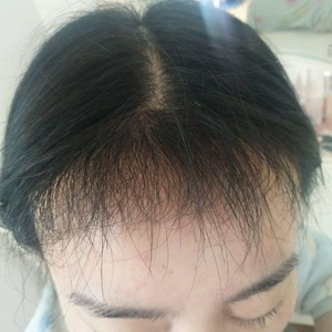 发际线分享社区