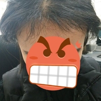 發(fā)際線用戶圖片