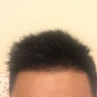 發(fā)際線用戶圖片