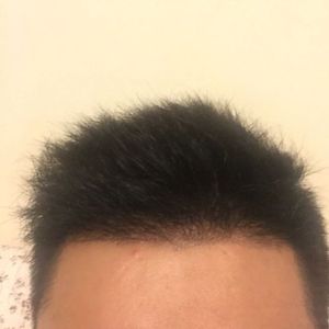 发际线分享社区