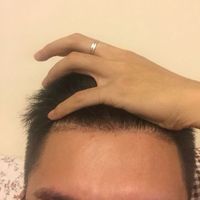 發(fā)際線用戶圖片