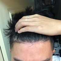發(fā)際線用戶圖片