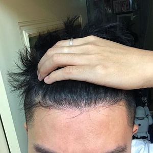 发际线分享社区
