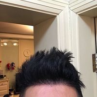發(fā)際線用戶圖片