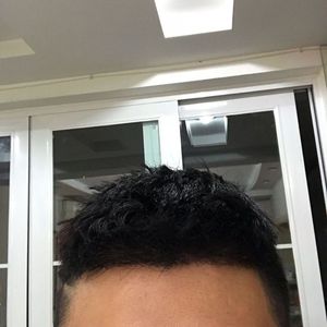 发际线分享社区