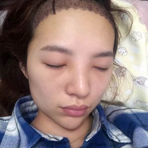 发际线分享社区