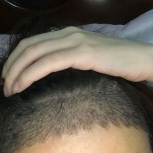 发际线分享社区