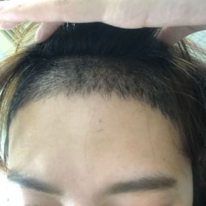 发际线分享社区