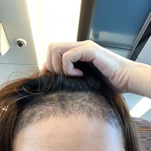 发际线分享社区