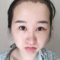 發(fā)際線用戶圖片