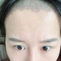 發(fā)際線用戶圖片