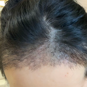 发际线分享社区