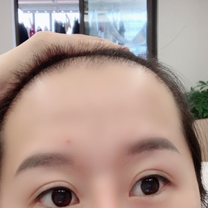发际线分享社区