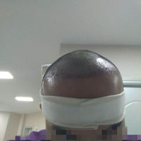 發(fā)際線用戶圖片