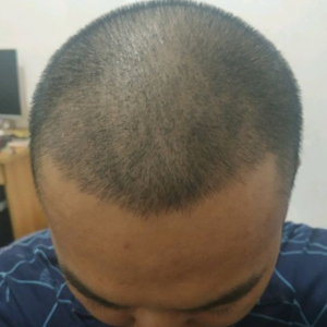 发际线分享社区