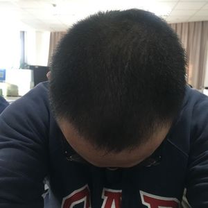 发际线分享社区