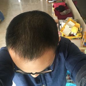 发际线分享社区