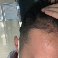 發(fā)際線用戶圖片