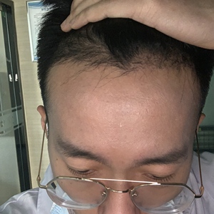 发际线分享社区