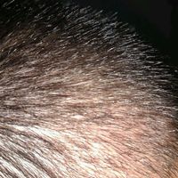 發(fā)際線用戶圖片