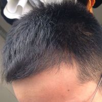 發(fā)際線用戶圖片
