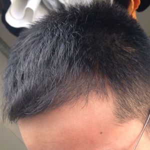 发际线分享社区