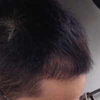 發(fā)際線用戶圖片