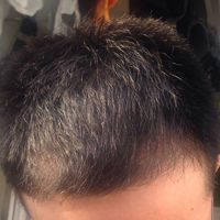 發(fā)際線用戶圖片