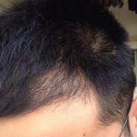 發(fā)際線用戶圖片