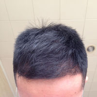 發(fā)際線用戶圖片